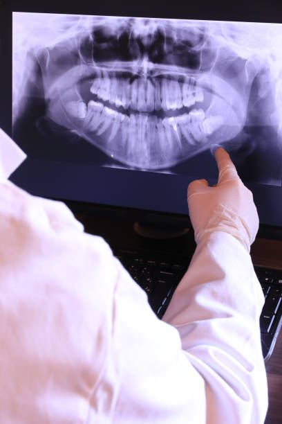 Best Emergency Treatment for Toothache in Albion, IN